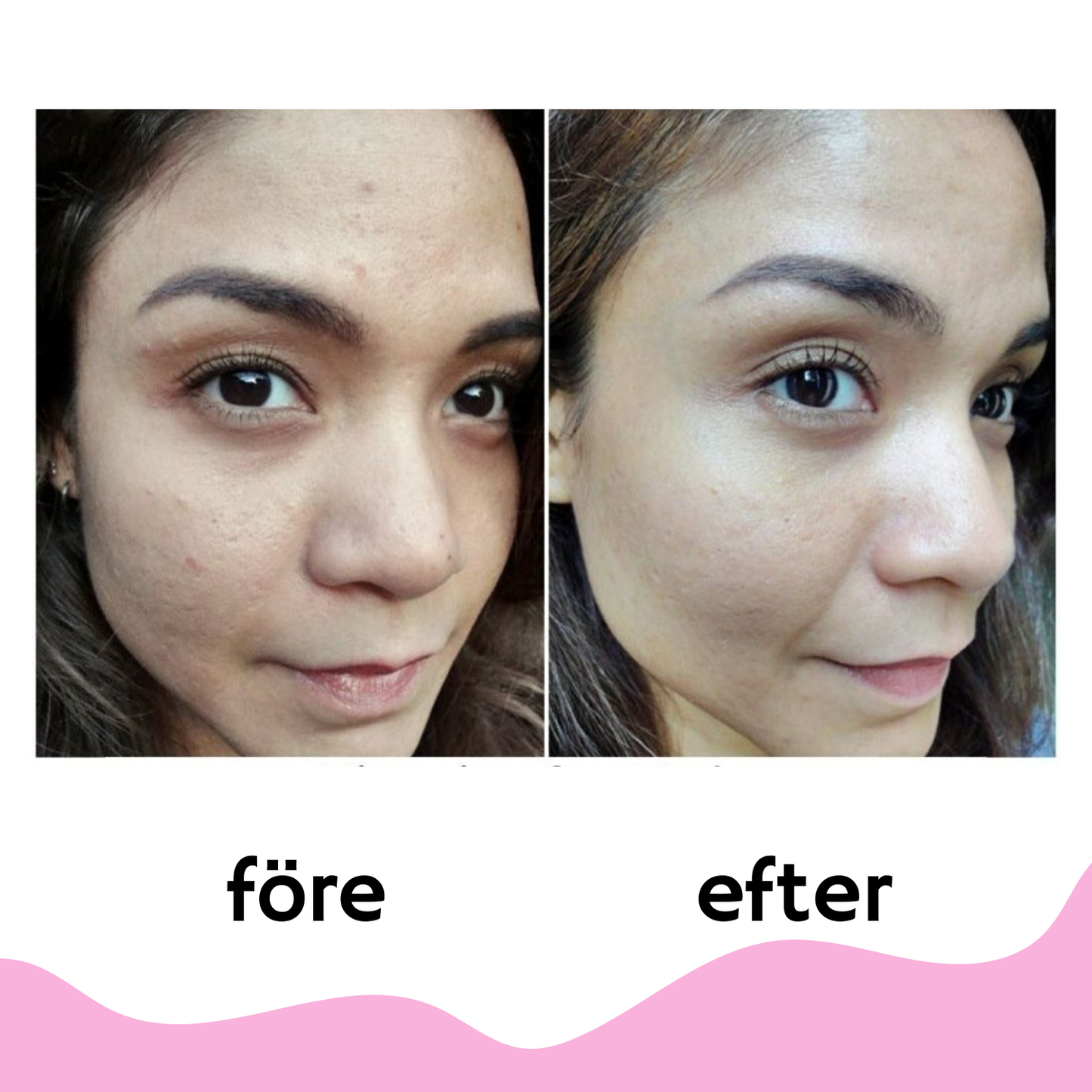InfraMask™ Red Light Therapy Mask